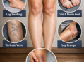 Legs can reveal hidden health issues such as heart failure, PAD, and diabetes: 5 signs your legs can warn you about hidden diseases